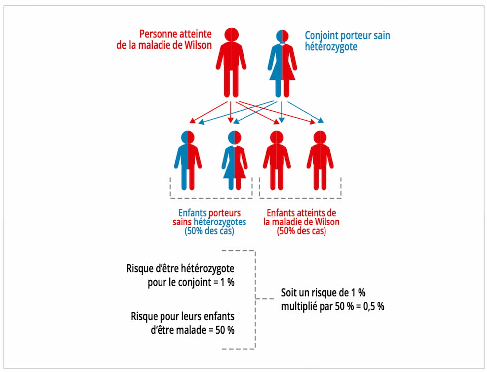 Conjoint heterozygote maladie Wilson