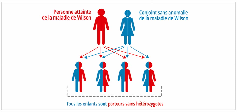 Conjoint sans anomalie Wilson